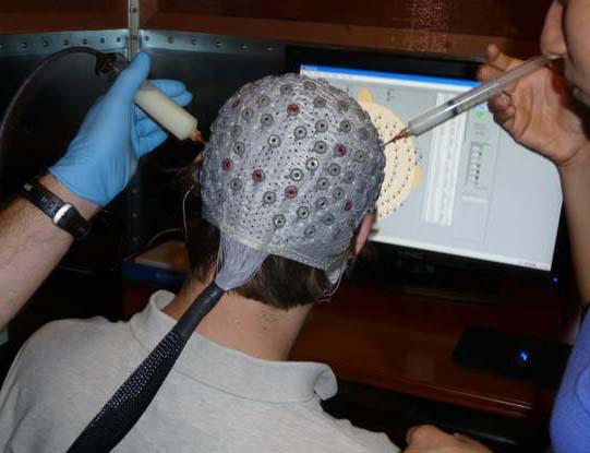 EEG preparation