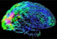 NIH Brain Map