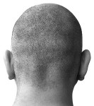 bald-266x300