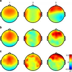 brain-activity