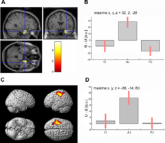 Golden ratio brain scan data