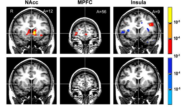 fMRI scans of brain showing the pain of paying, i.e., activating insula region
